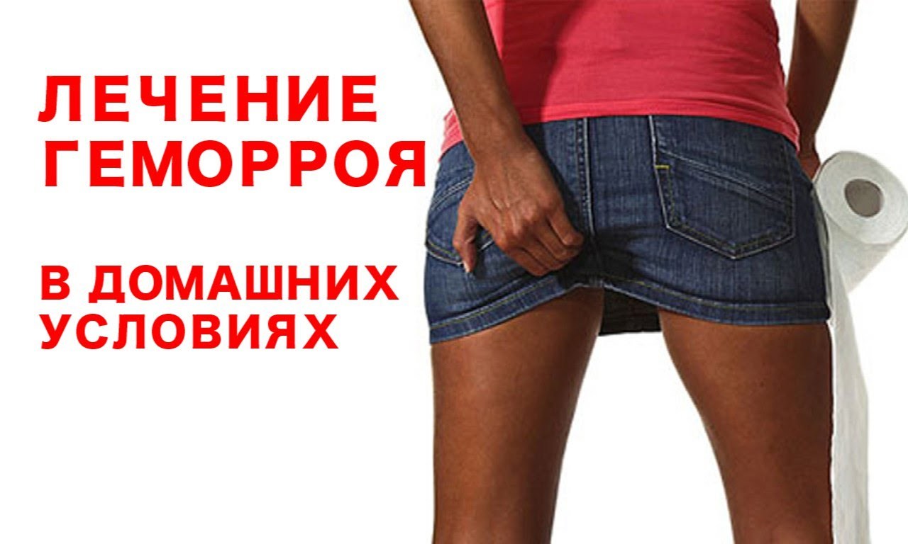 Как лечат геморрой в домашних условиях 629